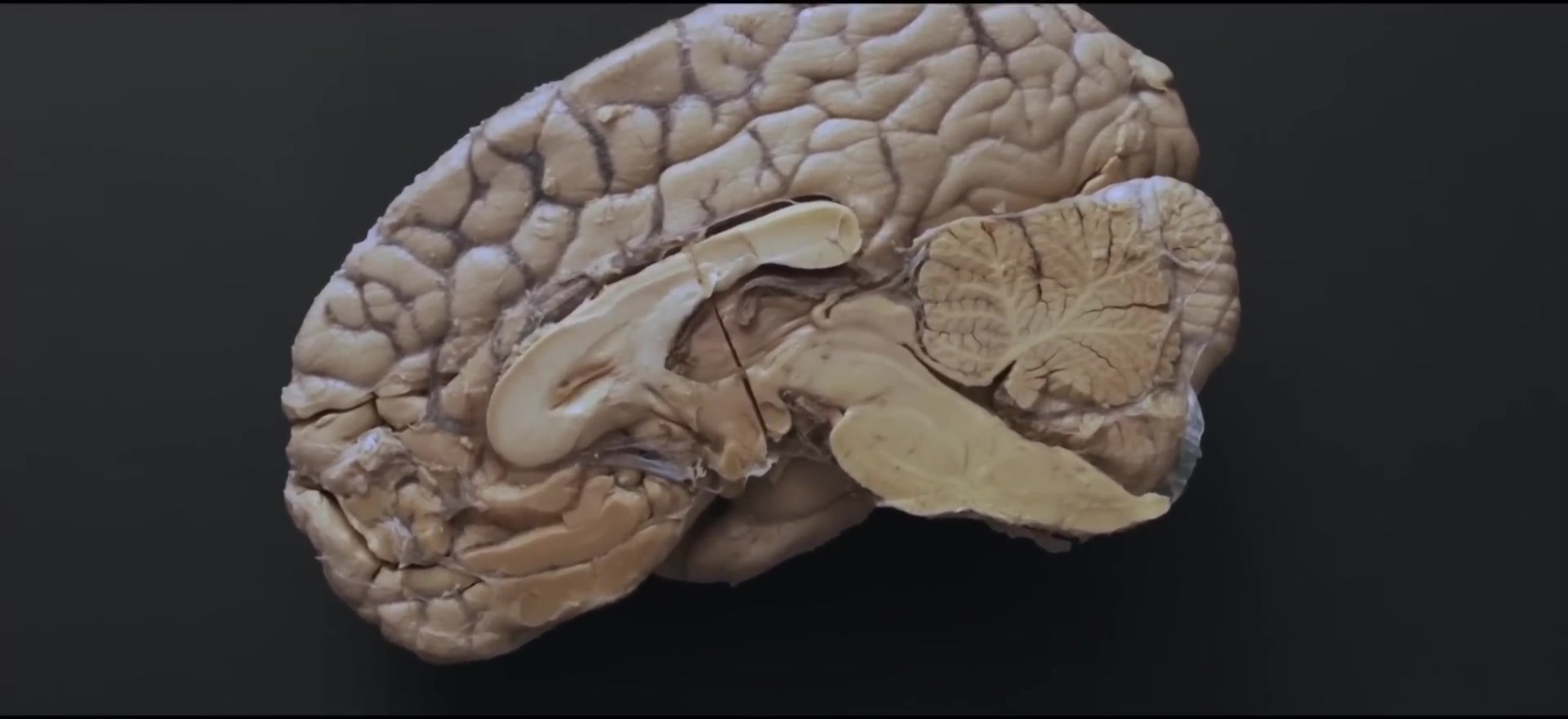 Brain capsules called neurons