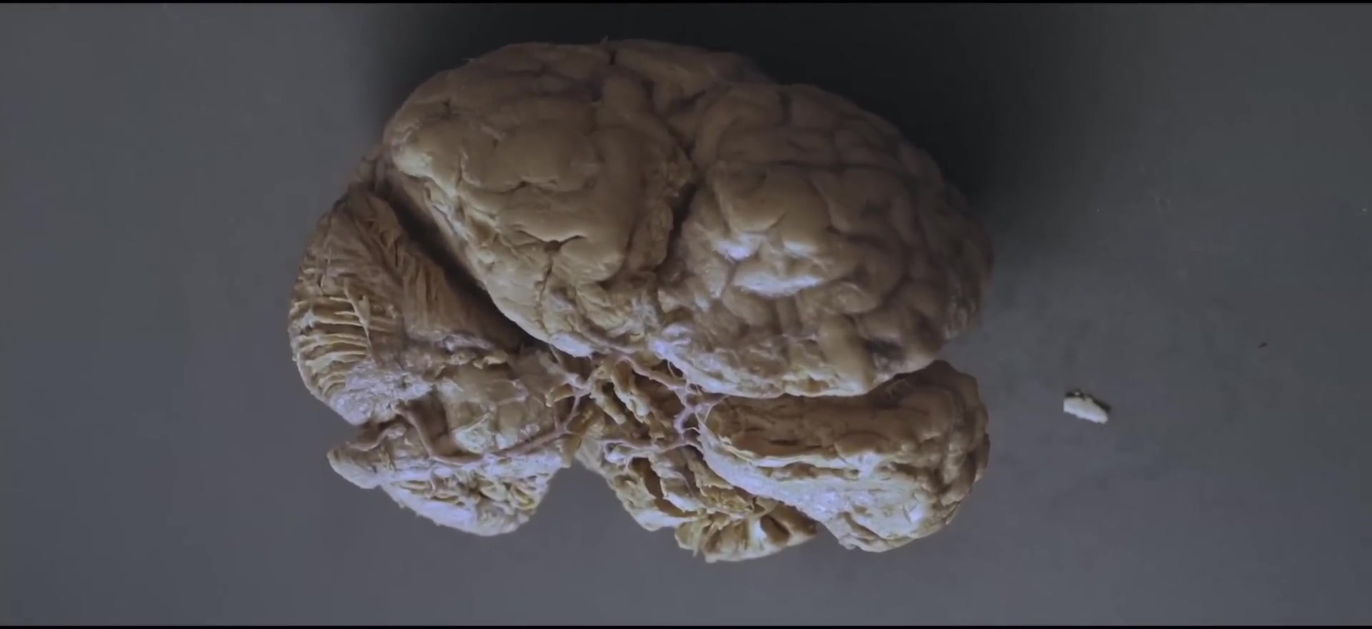 Quarter million specialized neurons