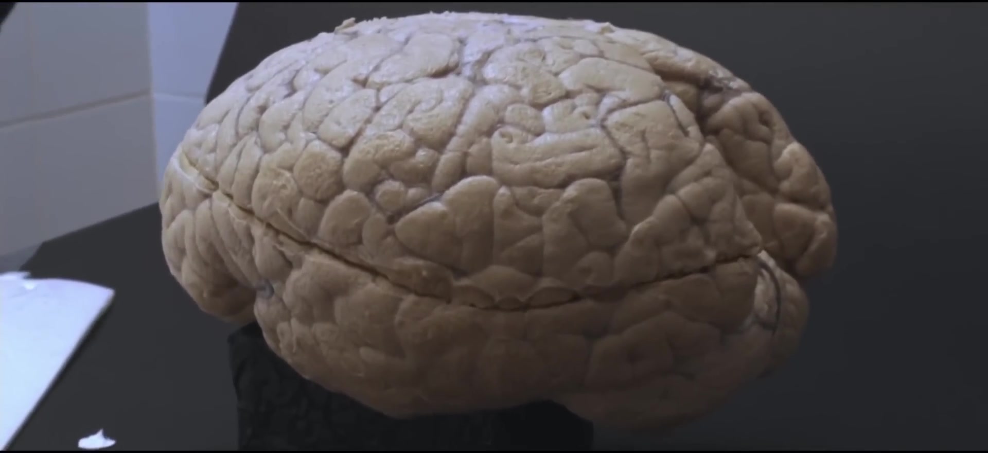 Brain stem primitive